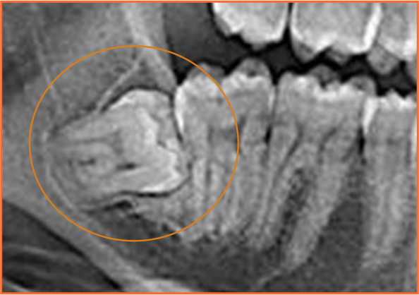 Stomatologia chirurgiczna Warszawa PaNa klinica